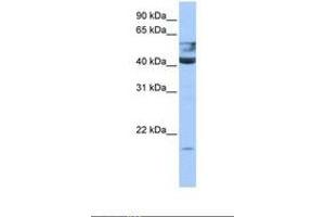 Image no. 1 for anti-Queuine tRNA-Ribosyltransferase 1 (QTRT1) (AA 45-94) antibody (ABIN6738529) (QTRT1 Antikörper  (AA 45-94))