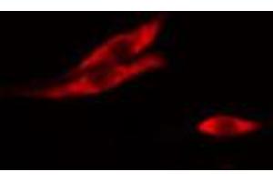 ABIN6267021 staining A-431 cells by IF/ICC.