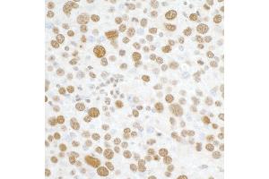 Immunohistochemistry (IHC) image for anti-H2A Histone Family, Member X (H2AFX) (C-Term) antibody (ABIN7449536)