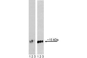 Western blot analysis of H2AX (pS139) in transformed human epithelioid carcinoma. (H2AFX Antikörper  (pSer139))