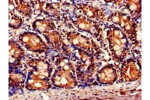 Immunohistochemistry of paraffin-embedded human small intestine tissue using ABIN7145827 at dilution of 1:100 (TNFAIP1 Antikörper  (AA 233-316))