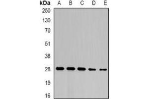 Western blot analysis of NFU1 expression in SW480 (A), mouse liver (B), mouse heart (C), rat liver (D), rat heart (E) whole cell lysates. (NFU1 Antikörper)