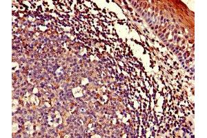 Immunohistochemistry of paraffin-embedded human tonsil tissue using ABIN7143153 at dilution of 1:100 (ASCC1 Antikörper  (AA 1-315))