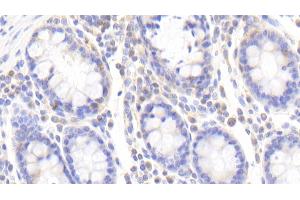 Immunohistochemistry (IHC) image for anti-DnaJ (Hsp40) Homolog, Subfamily C, Member 2 (DNAJC2) (AA 442-621) antibody (ABIN7444601)