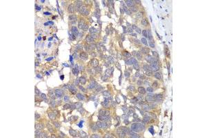 Immunohistochemistry (IHC) image for anti-Hyaluronan and Proteoglycan Link Protein 1 (HAPLN1) (AA 165-354) antibody (ABIN6141601)