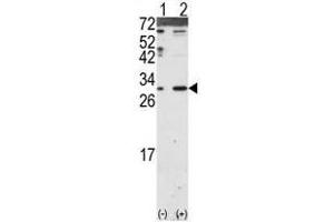Image no. 2 for anti-Dickkopf 2 Homolog (DKK2) (N-Term) antibody (ABIN357069) (DKK2 Antikörper  (N-Term))