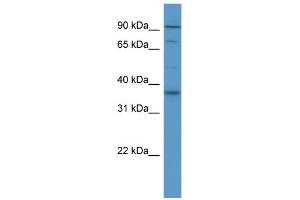 WB Suggested Anti-FGFR2 Antibody Titration: 0. (FGFR2 Antikörper  (Middle Region))
