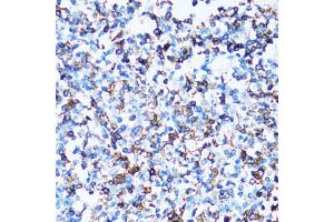 Immunohistochemistry of paraffin-embedded human tonsil using SPN antibody (ABIN5973813) at dilution of 1/100 (40x lens). (CD43 Antikörper)