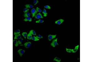 Immunofluorescence staining of Hela cells with ABIN7148294 at 1:166, counter-stained with DAPI. (MCC Antikörper  (AA 479-611))