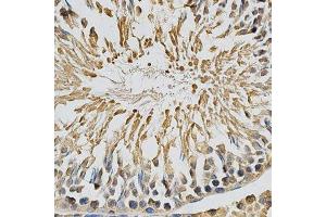 Immunohistochemistry (Paraffin-embedded Sections) (IHC (p)) image for anti-Cytochrome P450, Family 1, Subfamily A, Polypeptide 1 (CYP1A1) (AA 200-460) antibody (ABIN3023076)