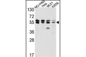 Western blot analysis of IDH2 Antibody (Center) (ABIN391584 and ABIN2841516) in NCI-,Hela,MCF7, cell line lysates(35 μg/lane). (IMPDH2 Antikörper  (AA 180-210))