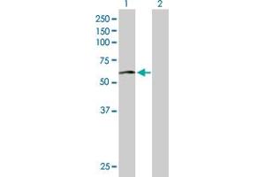 Western Blot analysis of ACCS expression in transfected 293T cell line by ACCS MaxPab polyclonal antibody. (PHACS Antikörper  (AA 1-501))