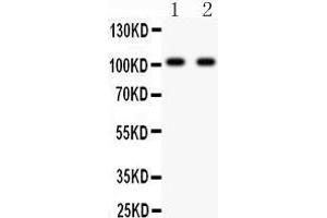 Anti- GRIA3 antibody, Western blotting All lanes: Anti GRIA3  at 0. (Glutamate Receptor 3 Antikörper  (AA 29-360))