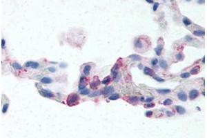 Human Lung, Neutrophils (formalin-fixed, paraffin-embedded) stained with EMR2 antibody ABIN213507 at 2-24 ug/ml followed by biotinylated goat anti-rabbit IgG secondary antibody ABIN481713, alkaline phosphatase-streptavidin and chromogen. (EMR2 Antikörper  (N-Term))