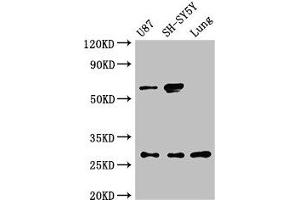 Western Blot Positive WB detected in: U87 whole cell lysate, SH-SY5Y whole cell lysate, Rat lung tissue All lanes: NEUROG2 antibody at 3 μg/mL Secondary Goat polyclonal to rabbit IgG at 1/50000 dilution Predicted band size: 29 kDa Observed band size: 29, 60 kDa (Neurogenin 2 Antikörper  (AA 194-262))