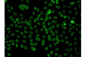 Immunofluorescence analysis of A549 cells using PLCXD2 antibody. (PLCXD2 Antikörper)