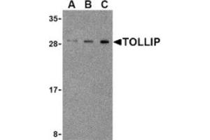 Image no. 1 for anti-Toll Interacting Protein (TOLLIP) (Middle Region) antibody (ABIN265154) (TOLLIP Antikörper  (Middle Region))