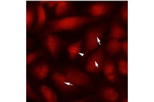 Immunofluorescence (IF) image for anti-Tubulin, beta 2B (TUBB2B) antibody (ABIN567612) (TUBB2B Antikörper)