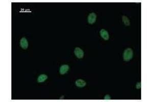 Immunostaining analysis in HeLa cells. (NRF2 Antikörper)