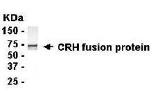 Image no. 1 for anti-Corticotropin Releasing Hormone (CRH) (AA 27-196) antibody (ABIN294738) (CRH Antikörper  (AA 27-196))