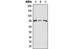 Western blot analysis of CD248 expression in HEK293T (A), NIH3T3 (B), H9C2 (C) whole cell lysates. (CD248 Antikörper  (Center))