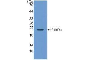Detection of Recombinant MGA, Human using Polyclonal Antibody to Maltase-glucoamylase (MGAM) (Maltase-Glucoamylase (MGAM) (AA 213-392) Antikörper)