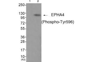 Western blot analysis of extracts from JK cells (Lane 2), using EPHA4 (Phospho-Tyr596) Antibody. (EPH Receptor A4 Antikörper  (pTyr596))