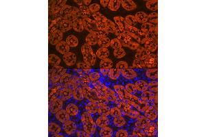 Immunofluorescence (IF) image for anti-Fructose-1,6-Bisphosphatase 1 (FBP1) antibody (ABIN7267269)