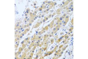 Immunohistochemistry of paraffin-embedded human liver using STC1 antibody (ABIN5975425) at dilution of 1/100 (40x lens). (Stanniocalcin 1 Antikörper)
