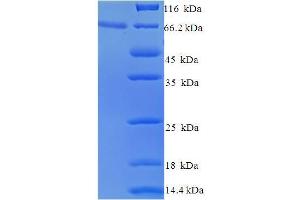 VL2 (AA 1-473), (full length) protein (His-SUMO Tag)