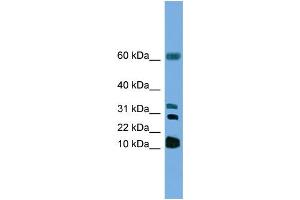 WB Suggested Anti-LTC4S Antibody Titration: 1. (LTC4S Antikörper  (N-Term))
