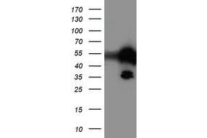 Western Blotting (WB) image for anti-T-Cell Acute Lymphocytic Leukemia 1 (TAL1) antibody (ABIN1501289) (TAL1 Antikörper)