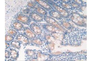 IHC-P analysis of Rat Intestine Tissue, with DAB staining. (Cytokeratin 18 Antikörper  (AA 72-380))