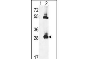 Western blot analysis of TPK1 (arrow) using rabbit polyclonal TPK1 Antibody (N-term) (ABIN653087 and ABIN2842683).