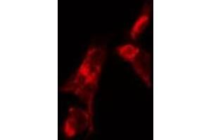 ABIN6268790 staining HUVEC by IF/ICC. (FSHR Antikörper  (Internal Region))