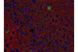 Indirect immunostaining of PFA fixed paraffin embedded mouse brain section with anti-SV2 B (dilution 1 : 500; red) and chicken anti-Parvalbumin (, dilution 1 : 500; green).