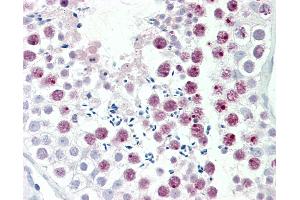 Human, Testis: Formalin-Fixed Paraffin-Embedded (FFPE). (MDC1 Antikörper  (AA 1851-1900))
