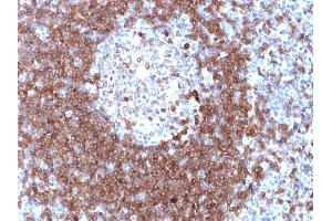 Formalin-fixed, paraffin-embedded human Tonsil stained with CD79a Rabbit Polyclonal Antibody. (CD79a Antikörper  (AA 202-216))