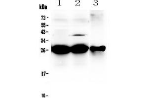 Western blot analysis of MBL2 using anti-MBL2 antibody . (MBL2 Antikörper  (AA 19-244))