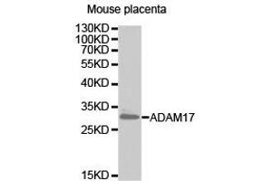 Western Blotting (WB) image for anti-ADAM Metallopeptidase Domain 17 (ADAM17) antibody (ABIN2650893)