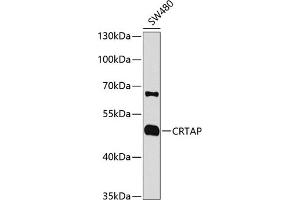 Western blot analysis of extracts of SW480 cells, using CRTAP antibody (ABIN1679366, ABIN3018913, ABIN3018914 and ABIN6220627) at 1:1000 dilution. (CRTAP Antikörper  (AA 20-240))