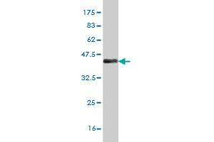 Western Blot detection against Immunogen (37 KDa) . (MEF2A Antikörper  (AA 71-170))