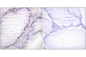 Immunohistochemistry analysis of paraffin-embedded human thyroid gland, using Fos (Phospho-Ser362) Antibody. (c-FOS Antikörper  (pSer362))