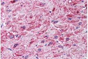 Human Heart (formalin-fixed, paraffin-embedded) stained with IKBKB antibody ABIN297183 at 2. (IKBKB Antikörper  (AA 310-376))
