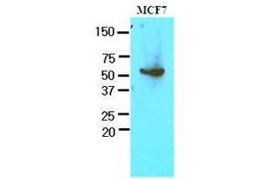 Cell lysates of MCF7 (30 ug) were resolved by SDS-PAGE, transferred to nitrocellulose membrane and probed with anti-human G6PD (1:1000). (Glucose-6-Phosphate Dehydrogenase Antikörper  (AA 35-506))