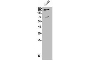 Western Blot analysis of HepG2 cells using COL5A2 Polyclonal Antibody (COL5A2 Antikörper  (N-Term))