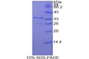 SDS-PAGE analysis of Human Nucleoporin 205 kDa Protein. (NUP205 Protein)