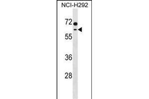 MCCC2 Antibody (C-term) (ABIN1537373 and ABIN2850364) western blot analysis in NCI- cell line lysates (35 μg/lane). (MCCC2 Antikörper  (C-Term))