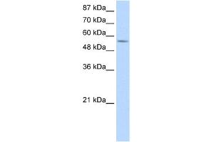 WB Suggested Anti-DDX47 Antibody Titration:  1. (DDX47 Antikörper  (C-Term))