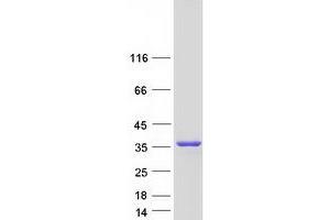 Western Blotting (WB) image for Deoxyhypusine Hydroxylase/monooxygenase (DOHH) (Transcript Variant 1) protein (Myc-DYKDDDDK Tag) (ABIN2719644)